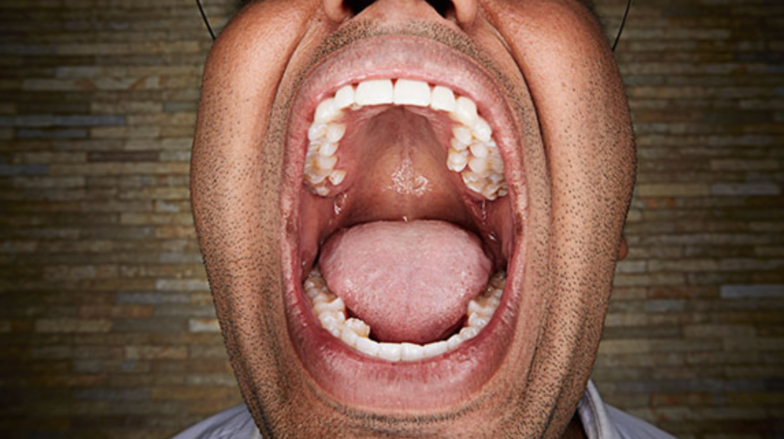 Most teeth ever