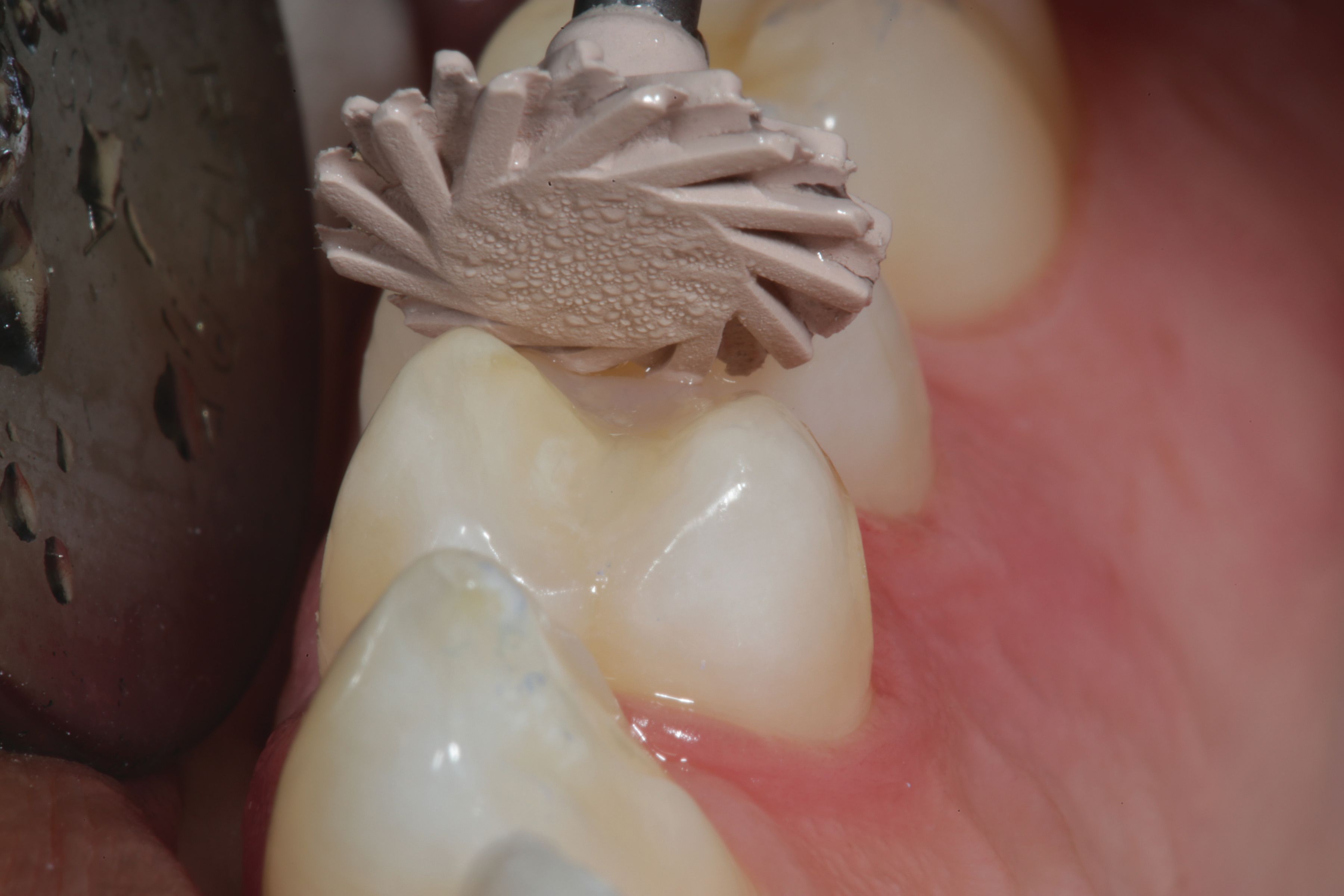 Figure 16