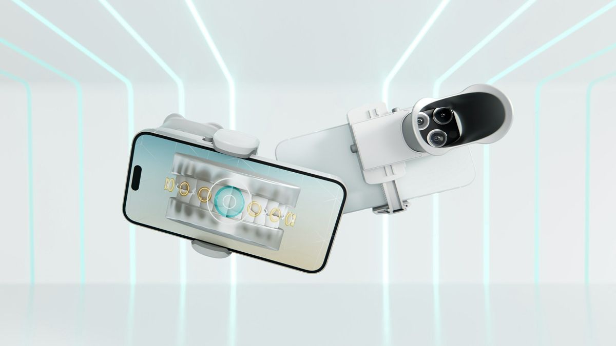 ScanAssist