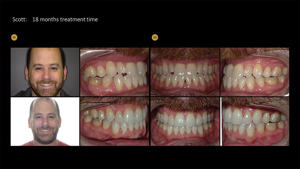 Featured product: VPro™
