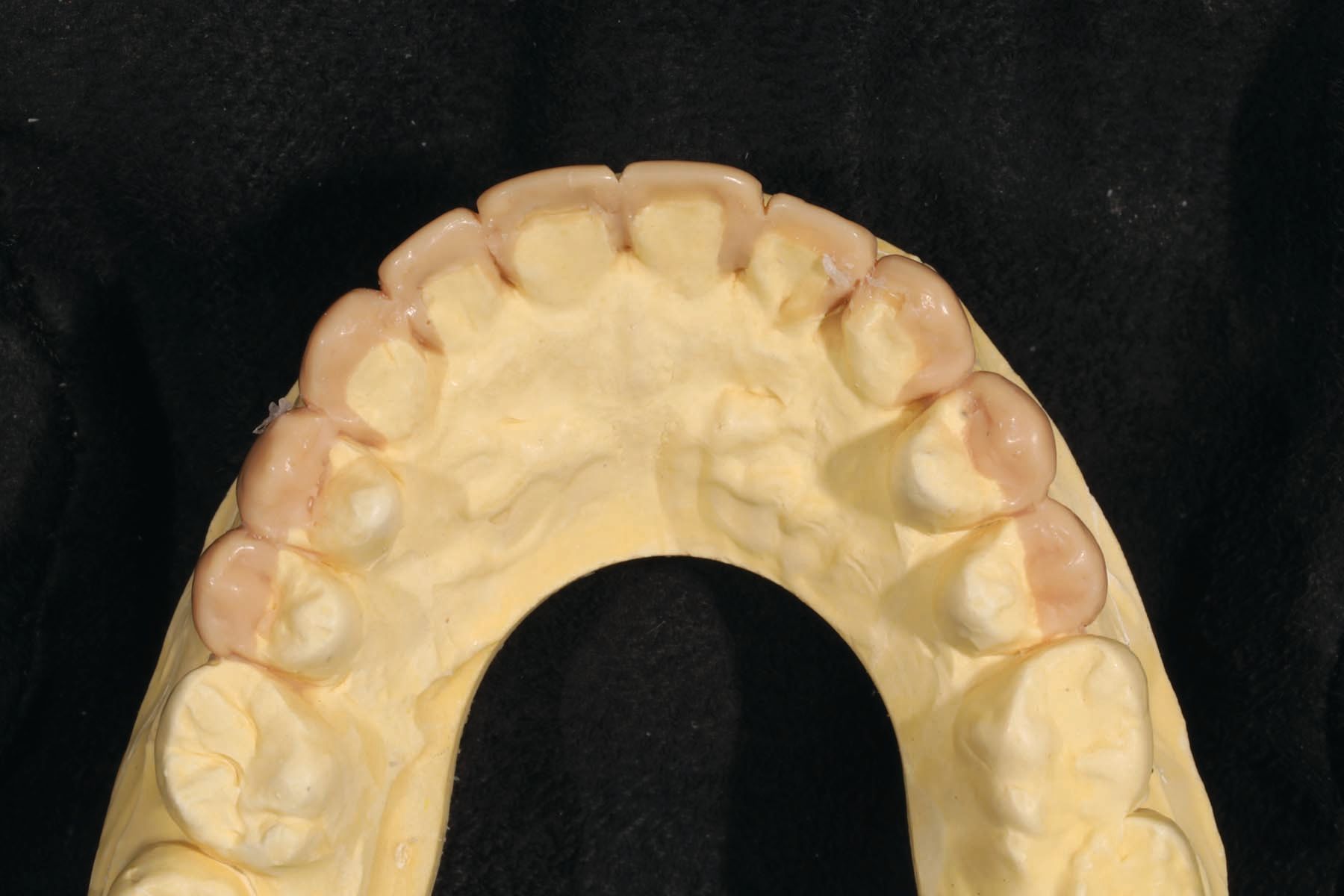 Figure 12. Diagnostic wax-up.