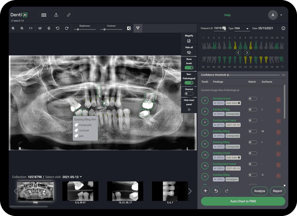 Denti.AI Auto-Chart