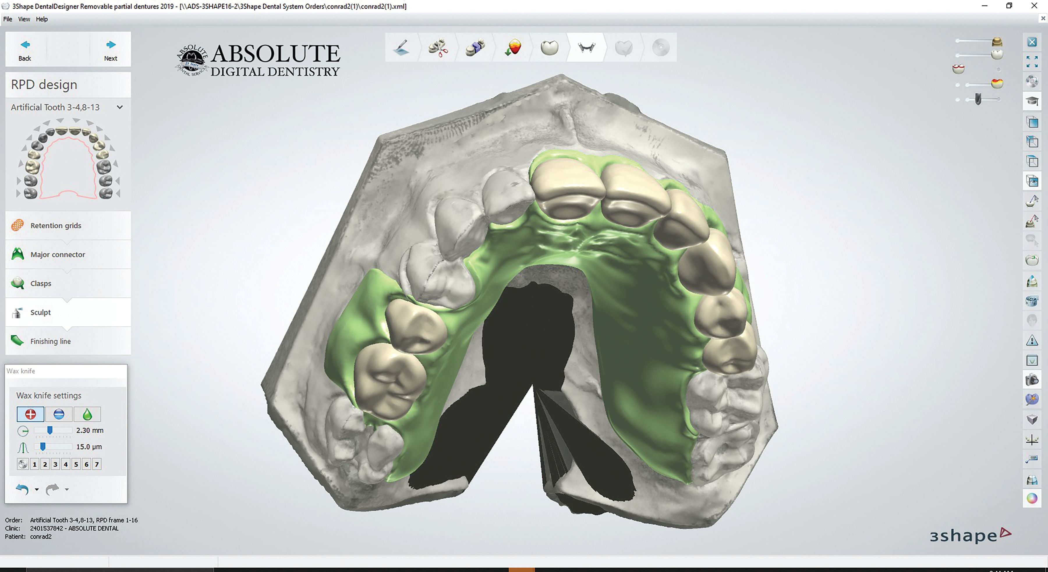 How to balance digital and analog design