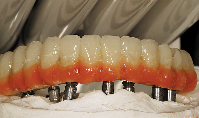 Step 11 Next, we see the results of the light-curing stage. We can note the difference between the three colors and the maximizing and mimicking of the natural tooth colors with white, blue, ochre and ivory stains, which appear to be different in each application.