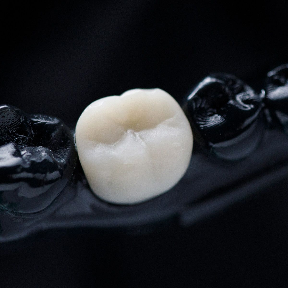 SprintRay Ceramic Crown from SprintRay | Image © SprintRay
