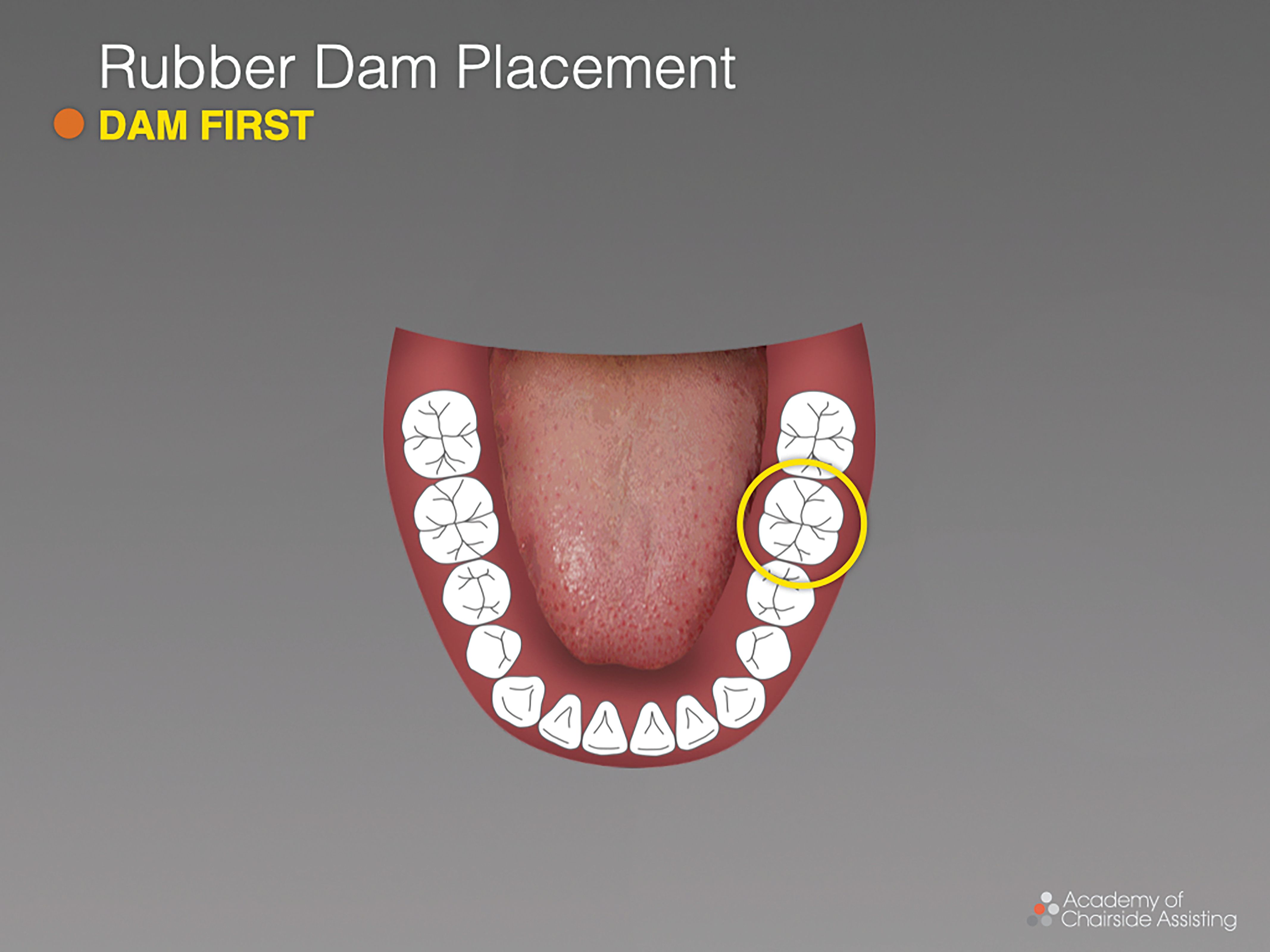 Figures 7-8. The oral cavity should be examined to determine the best anchor tooth, the shape of the arch, tooth alignment, and missing teeth. 