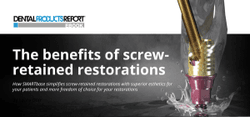E-Book: The Benefits of Screw-Retained Restorations