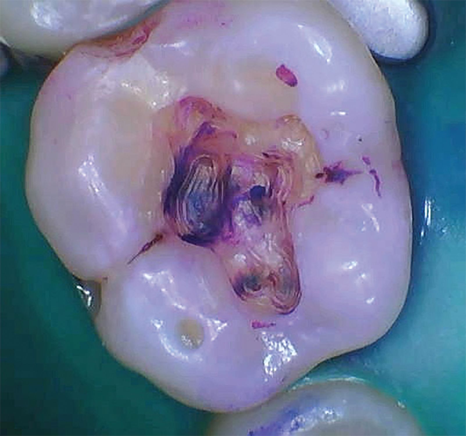 Omni-Chromatic Restorative