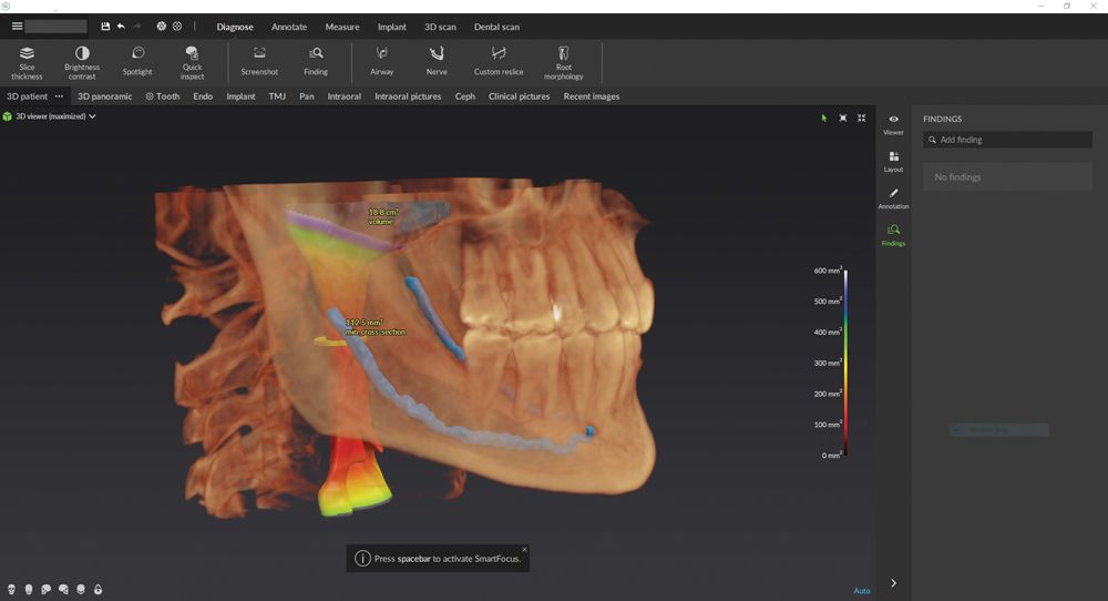 Figure 4 Clinical dental imaging often captures additional anatomy, and software that can automatically detect the airway and other landmarks enhances clinical efficiency.