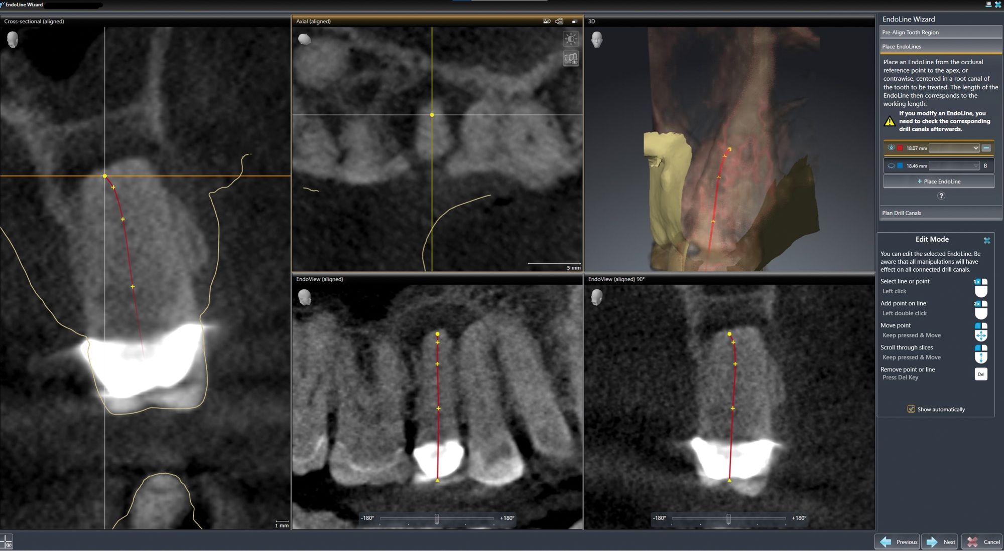 Endo Software How to Use Imaging and Treatment Planning Software for Guided ...