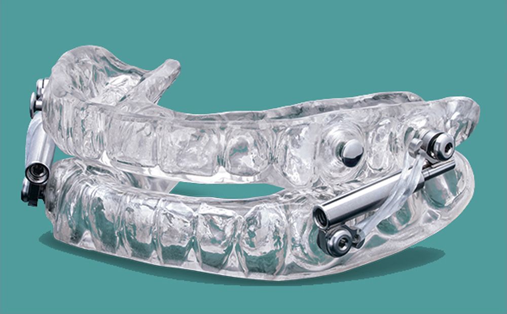 Silent Nite Sleep Appliance with Glidewell Hinge