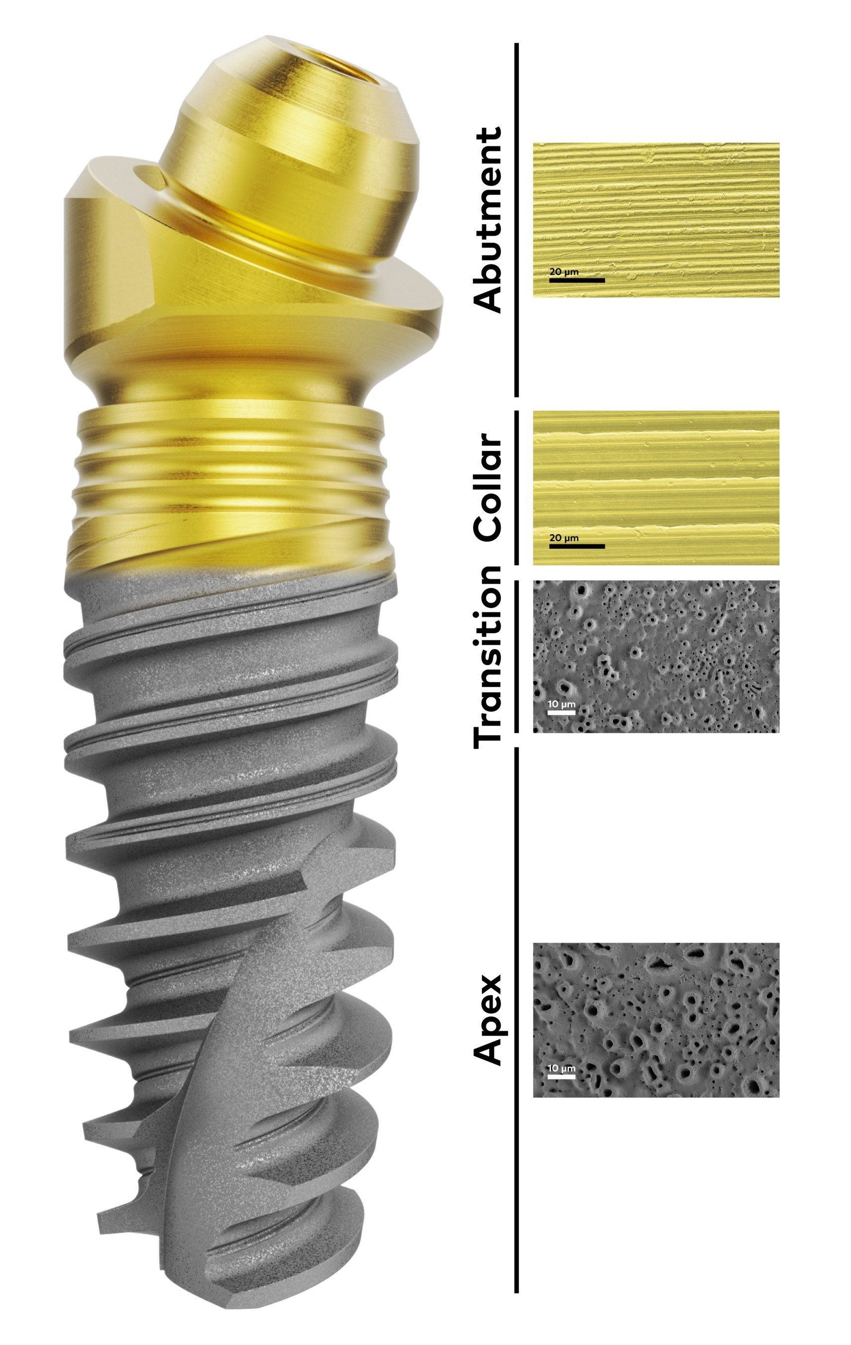 Nobel Biocare Launches Xeal and TiUltra Implant and Abutment Surfaces