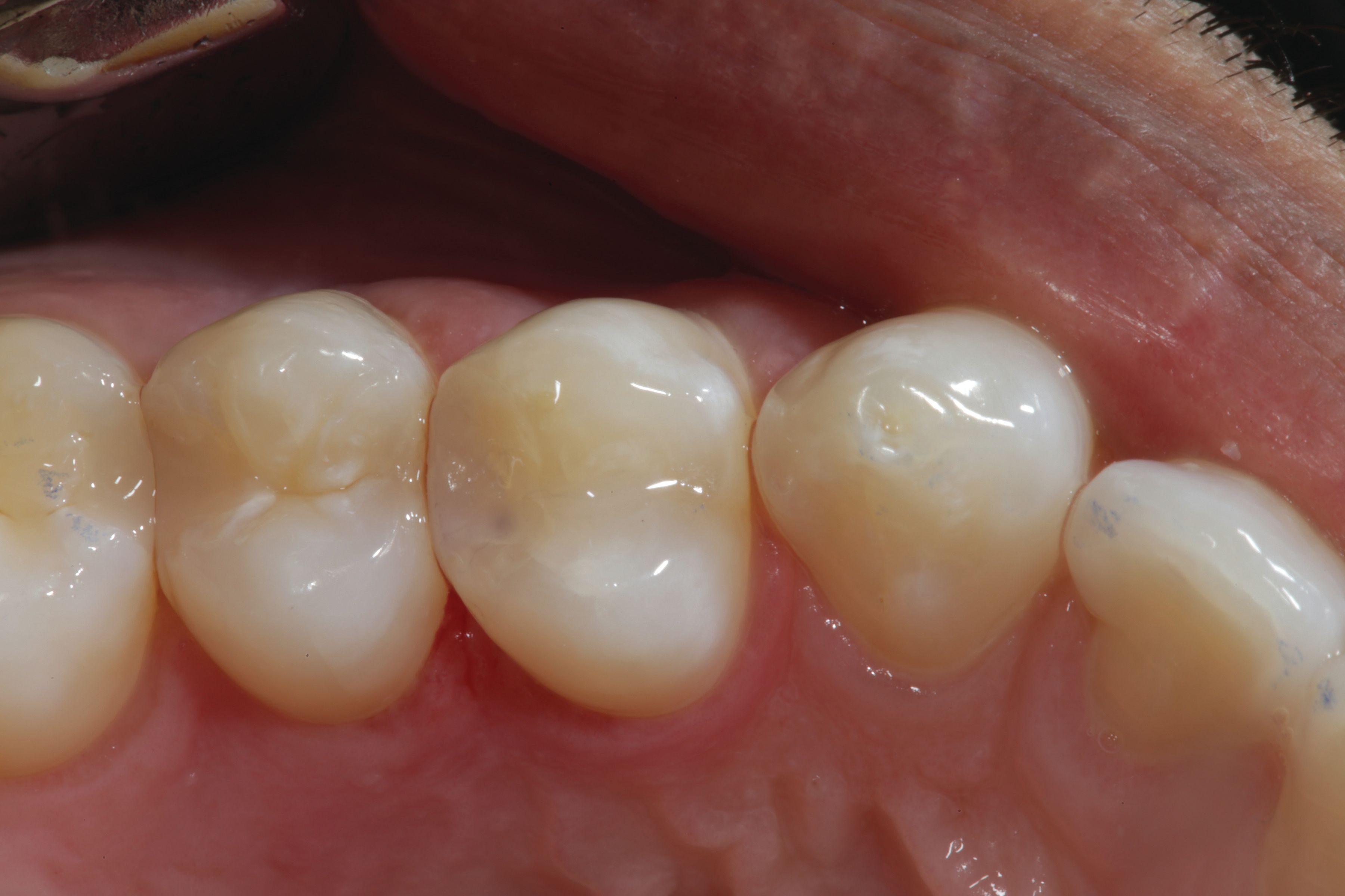 Figure 18