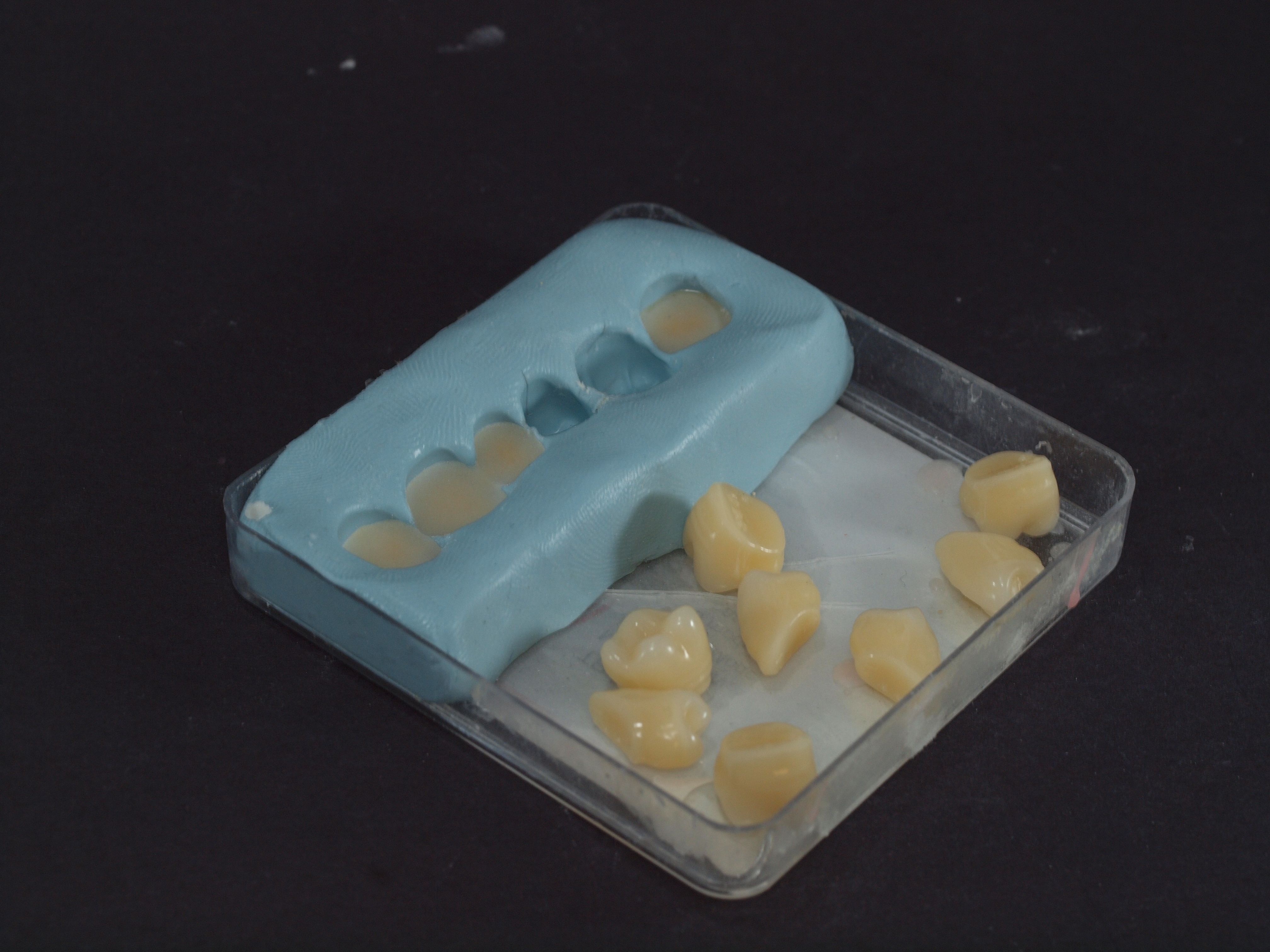 Lab putty duplication of denture teeth provide a low-cost way to provide a provisional appliance that guides the patient toward a warrantable and comprehensive treatment. 
