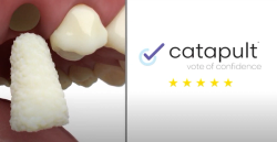  Catapult Vote of Confidence Video Product Review – BioHorizon’s MinerOss Plug