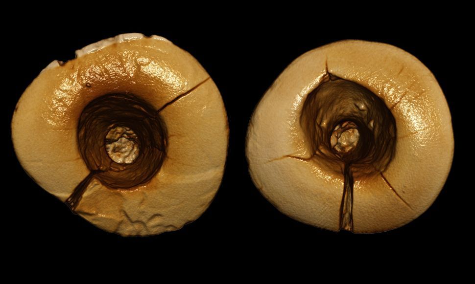 Earliest known dental fillings Image: © Stefano Benazzi