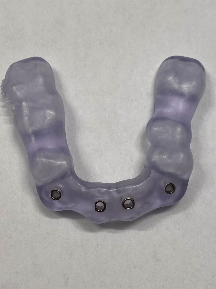 Merging of the 3D images allowed for proper implant planning and the printing of a surgical guide