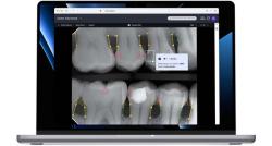 VideaHealth Artificial Intelligence Dental Assist Receives FDA Clearance