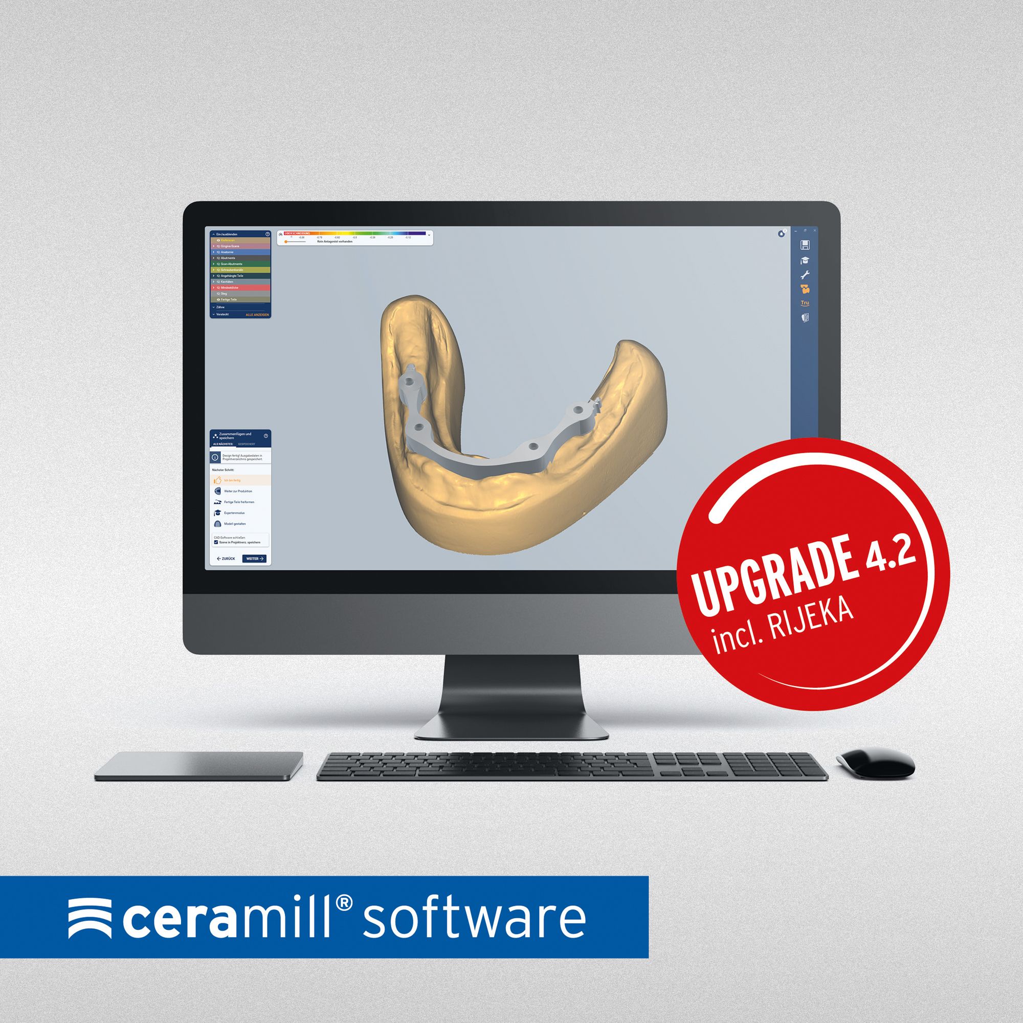 Ceramill Mind and Ceramill Match 4.2 Software