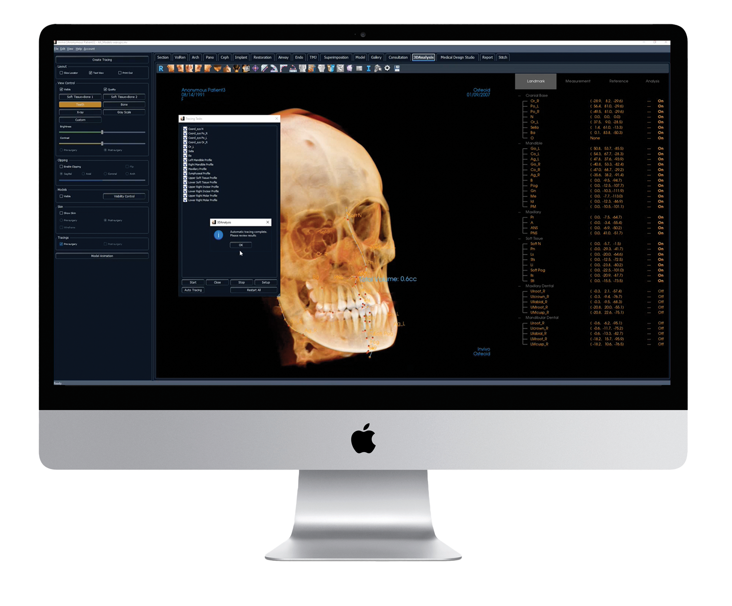 Invivo AI Cepholometric tracing