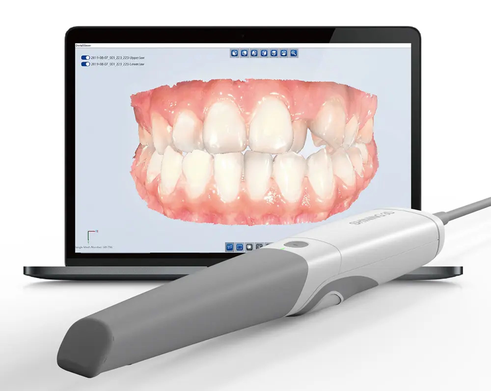 Shining 3D’s Aoralscan 3 Intraoral Scanner Loaded With New Features