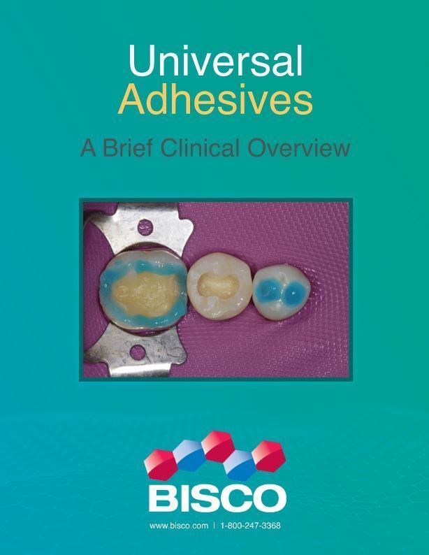 Universal Adhesives A Brief Clinical Overview