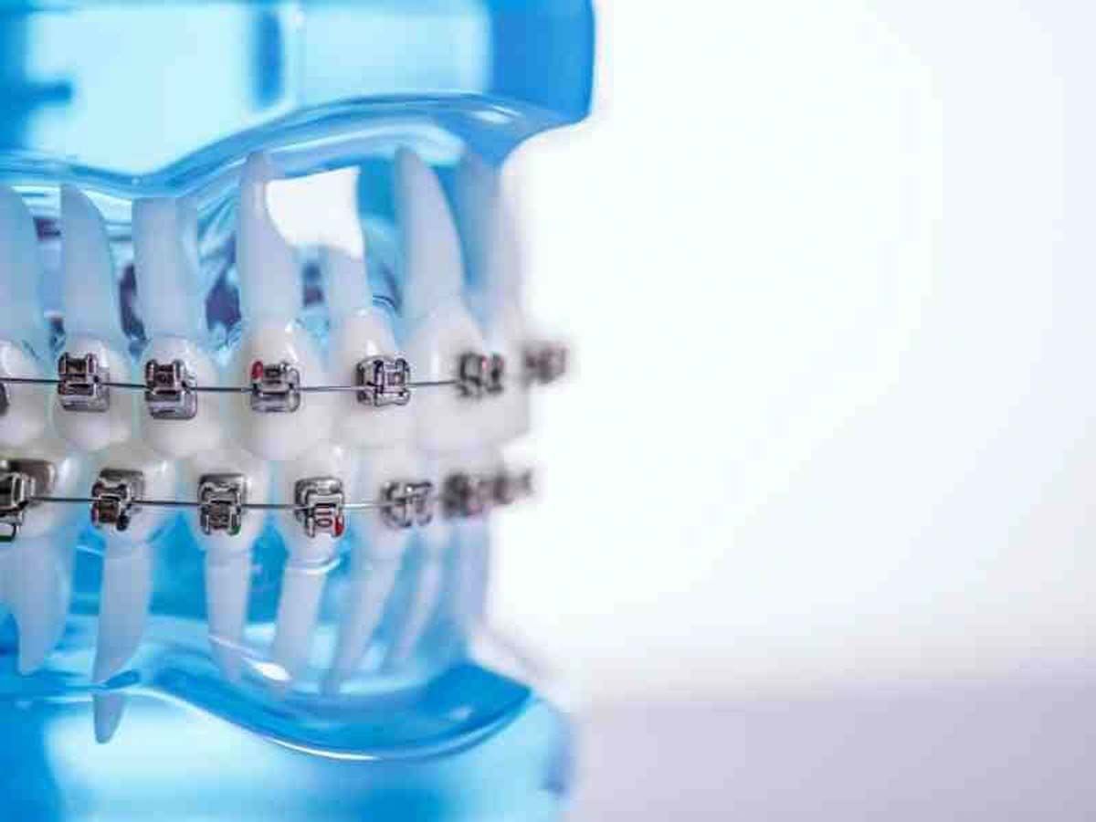Custom Dental Products