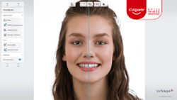 Colgate-Palmolive, 3Shape Team Up on Tailored-to-Patient Teeth Whitening Tool