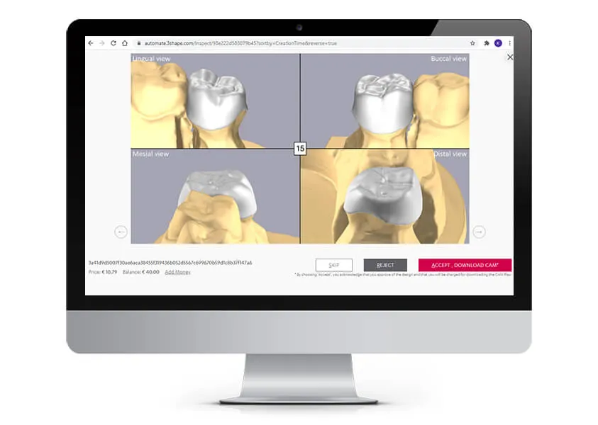 3Shape Automate