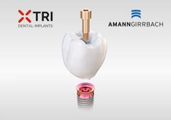 Amann Girrbach, TRI Dental Implants Partner for New Digital matrix Implant 