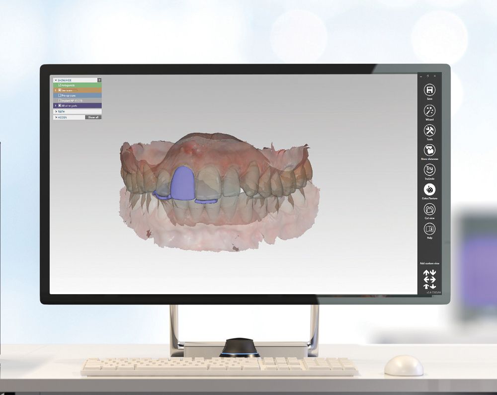 Figure 5 Digital waxups of proposed restorations can help patients visualize treatment outcomes.