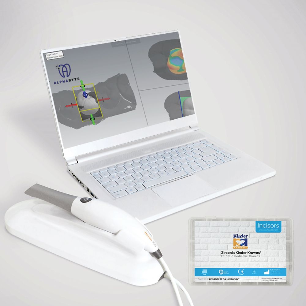 Intraoral Scanning System