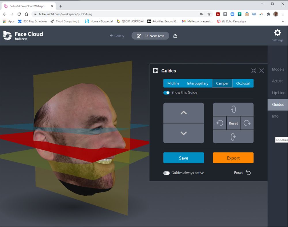 Bellus3D Dental Pro