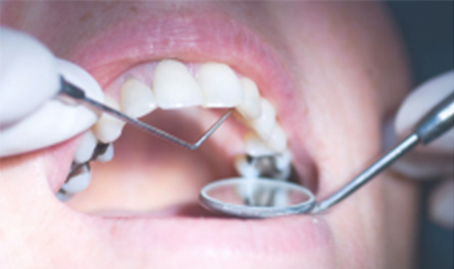 Pro Dentist Collection Amalgam Composite Filling Restorative Procedure Tools X11 