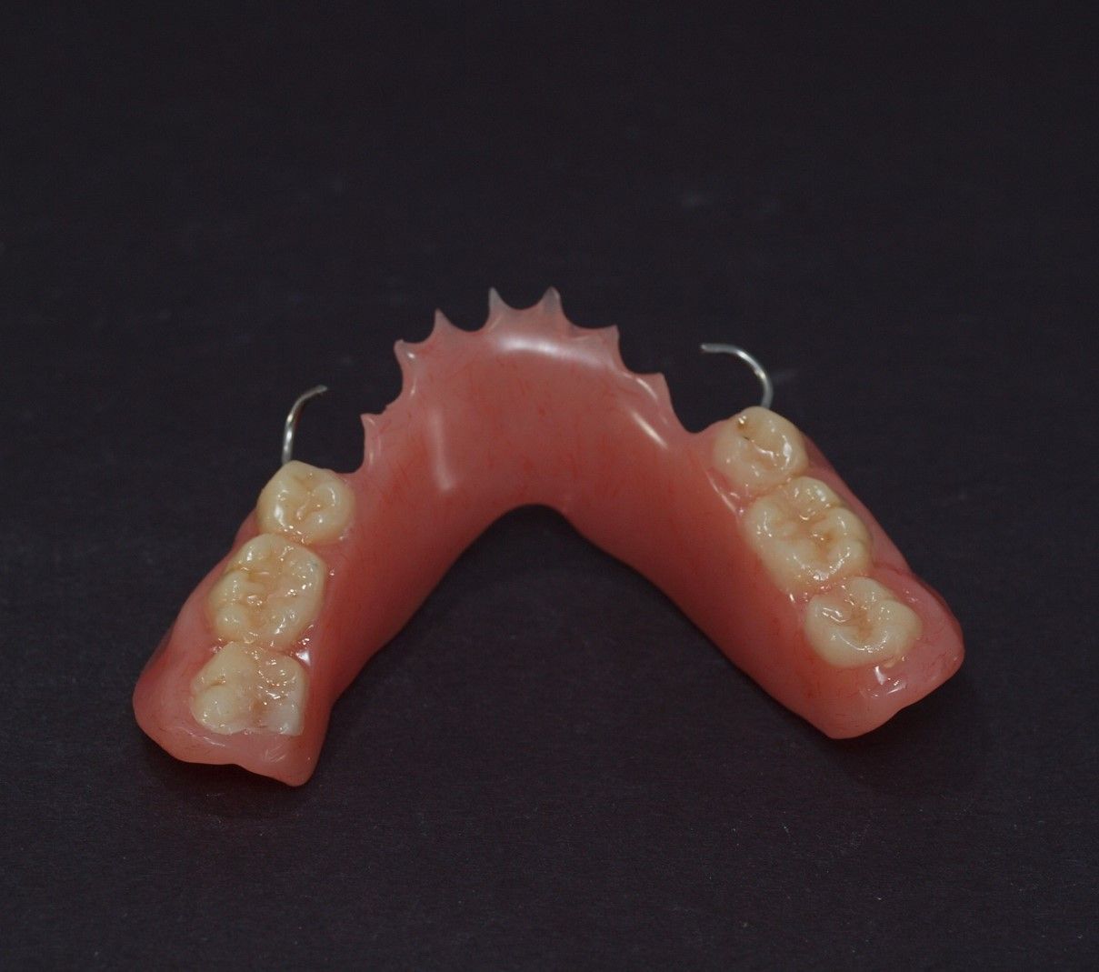 An all acrylic provisional including self-cure teeth. A fraction of the definitive cost but communicates the need for comprehensive treatment.