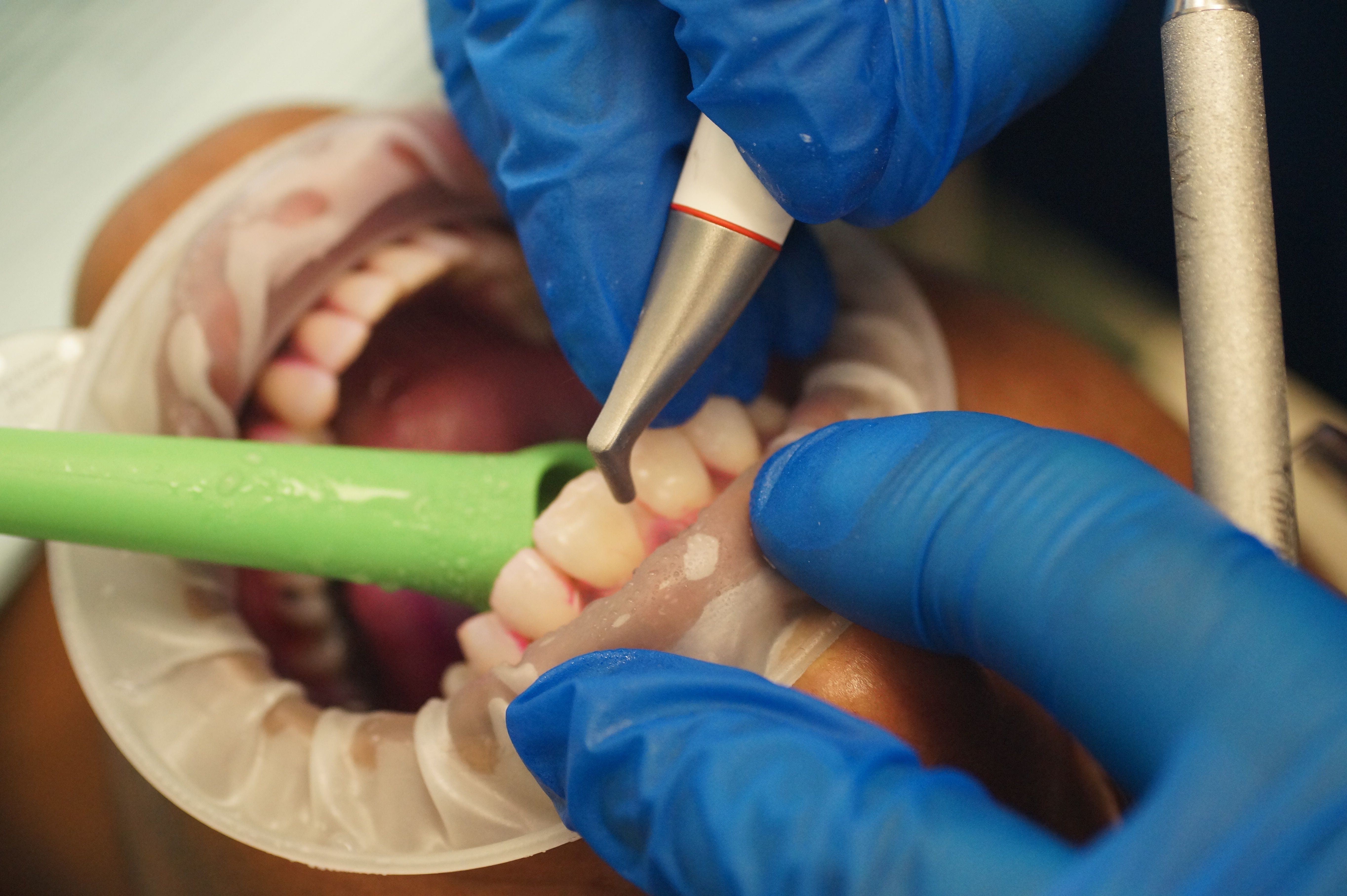 Guided Biofilm Therapy®  from EMS Dental | Image Credit: © Coastal Carolina Community College