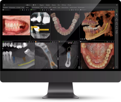 New DTX Studio™ Clinic v.4.3 Software Serves As the Unifying Software and Central Hub of the DEXIS Ecosystem