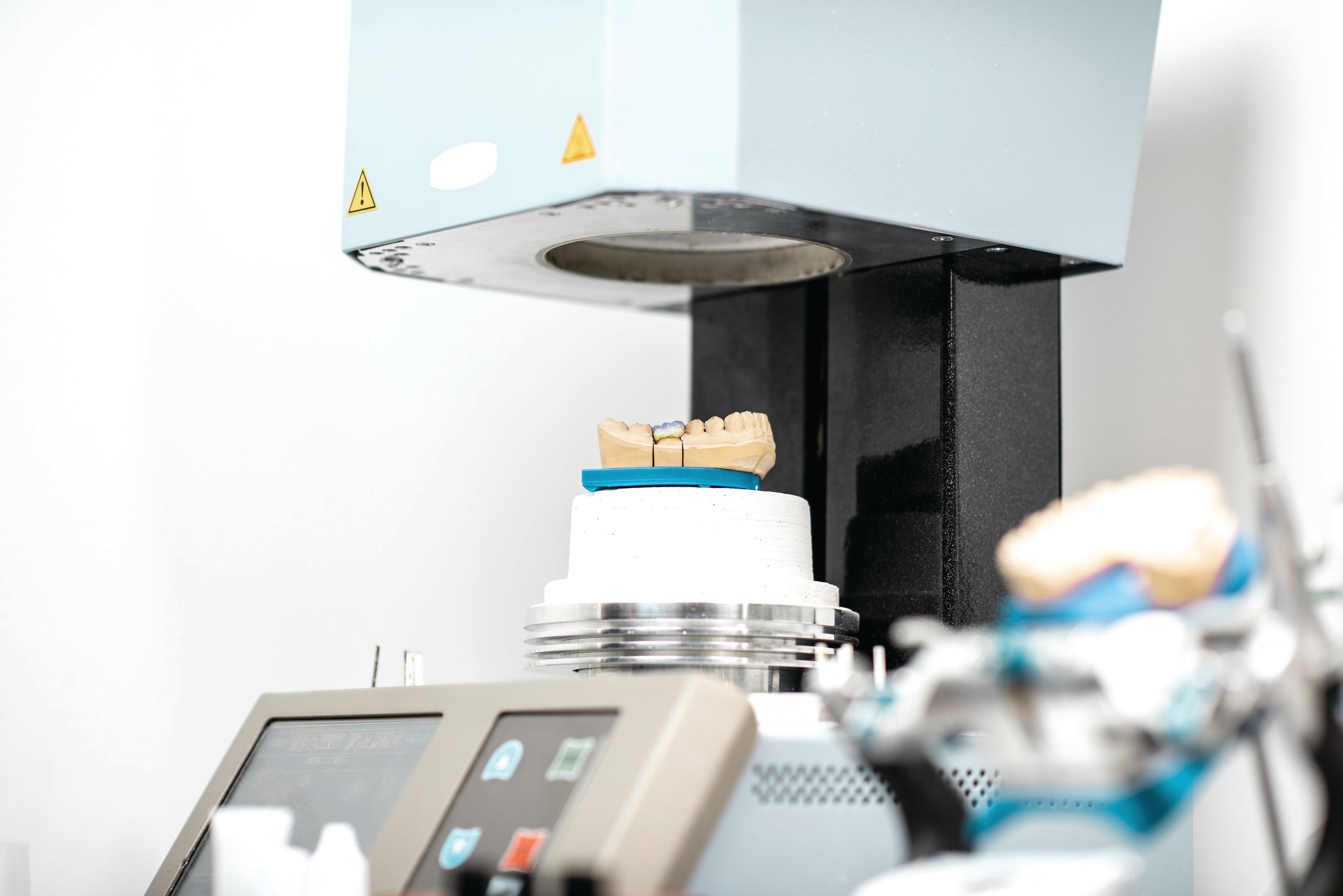 Precision and Reliability are the Keys to a Dental Furnace
