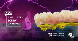 Panthera Dental Introduces New Panthera Fusion Bar