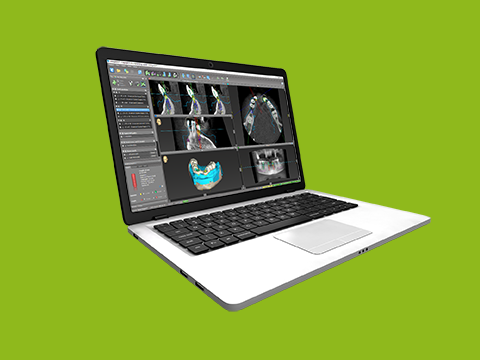 Changing the implant workflow