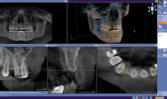 exporting x-rays galileos viewer