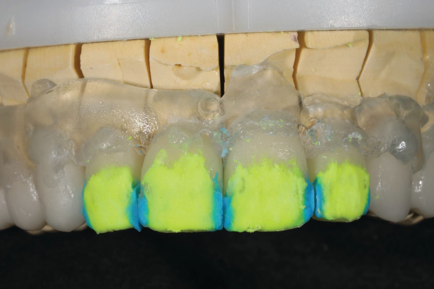 Figure 19. Enamel and opal layering over fired internal effects. 