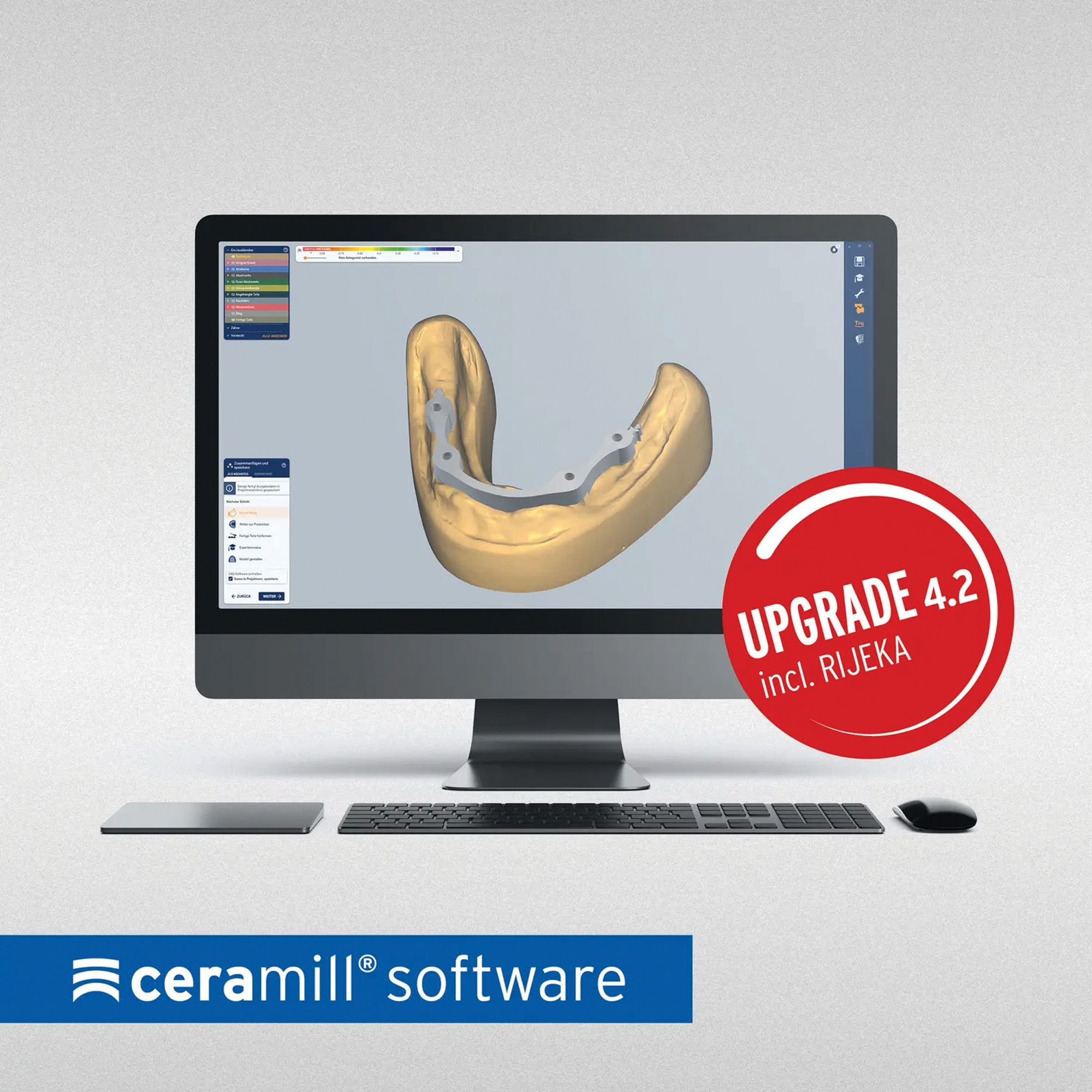 CAD/CAM Software  Ceramill Mind and Ceramill Match 4.2 Software