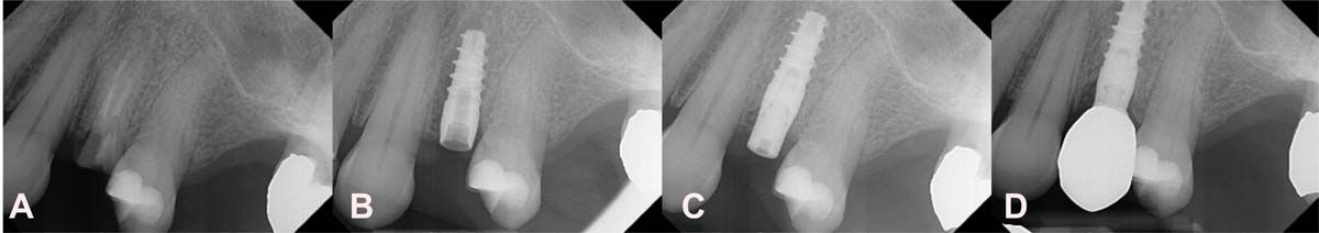 Figure 18