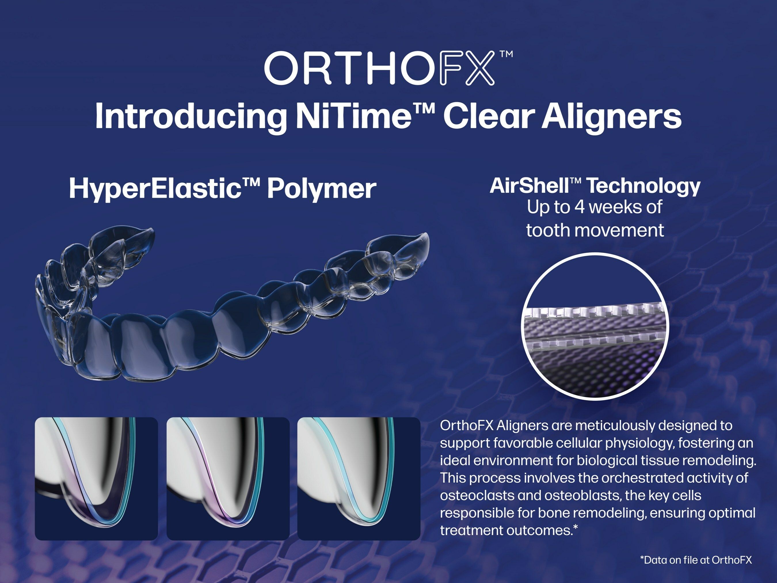 OrthoFX™ Aims to Enhance Orthodontic Treatment with NiTime™ Clear