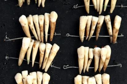 photo courtesy of the British Dental Association Museum