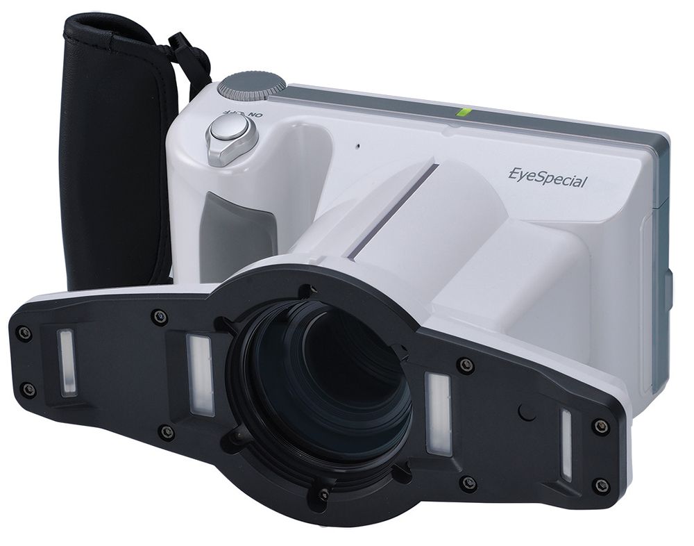 Shofu EyeSpecial Dental Camera