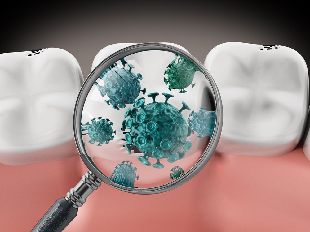 Oral Bacteria And Strokes - Alondra Dental AssociatesAlondra Dentist -  Alondra Dental Associates