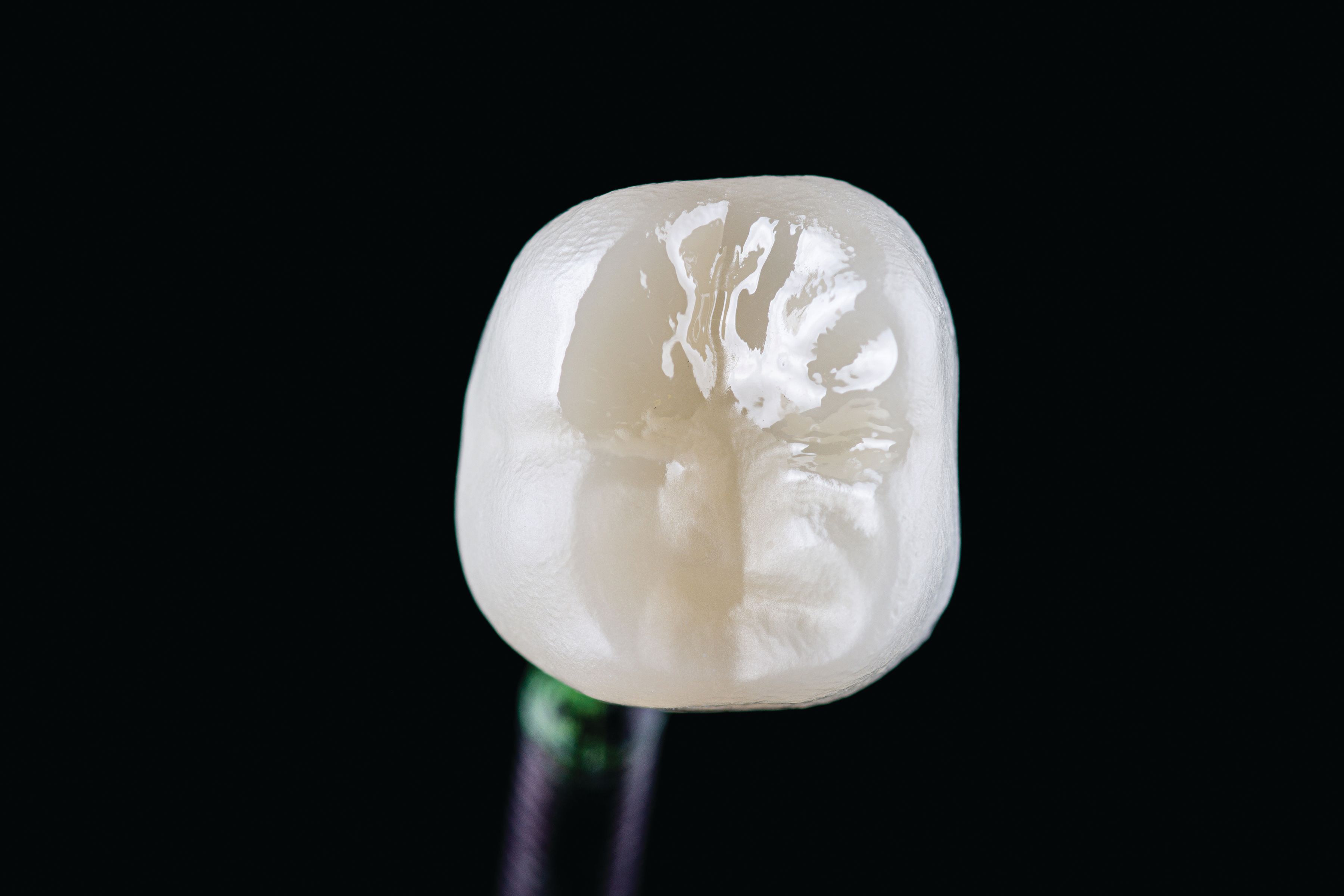 One side of a monolithic zirconia restoration has been polished with Speed Polish. The result is a high-gloss luster
