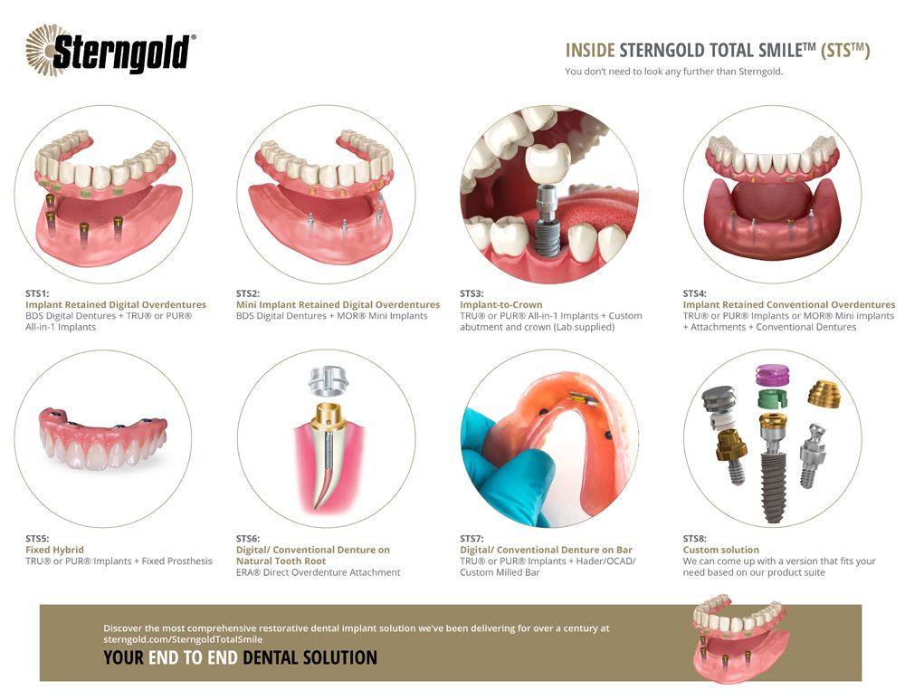 Sterngold Dental has announced its Sterngold Total Smile™ (STS). 